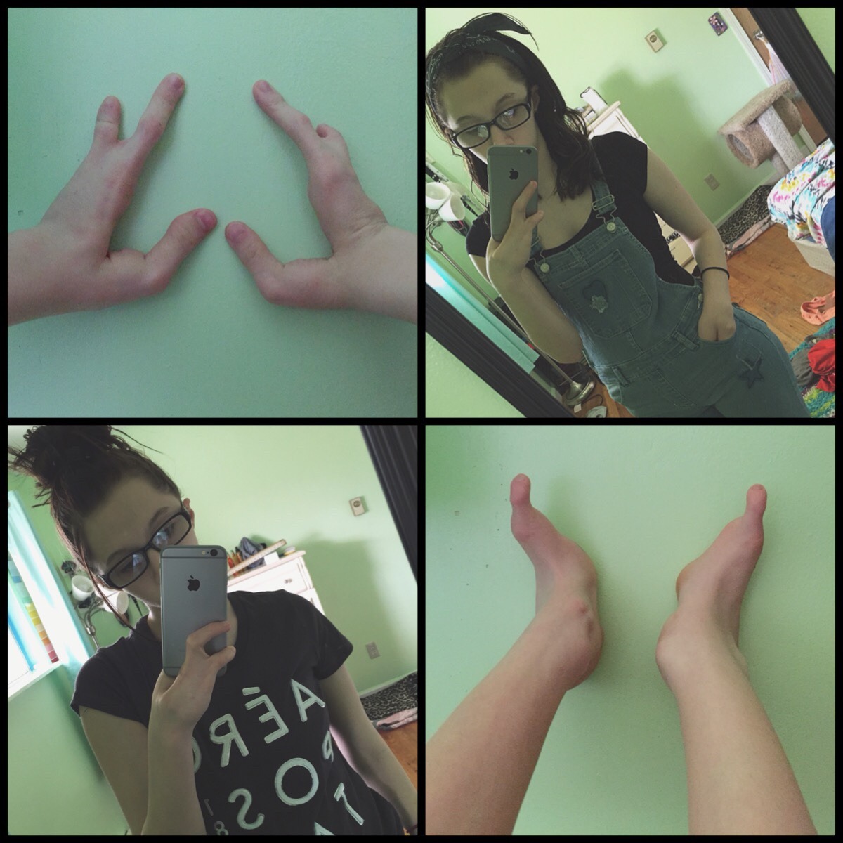 spider-feet:  strangestars:  Happy #NoShameDay  Hi, my name is hope, i turned 16