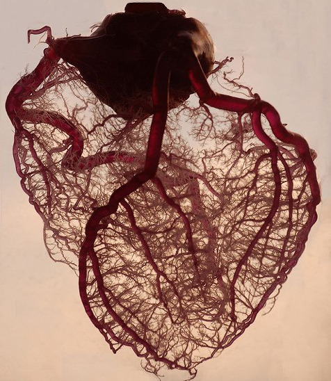  The human heart stripped of fat and muscle, with just the angel veins exposed. 