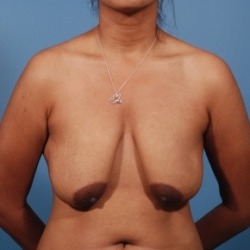 tits-r-hangin:  Her nipples are a bit cross-eyes,