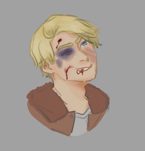 alviepines:tfw you beat up your favorite character for coloring practice… sorry Alfie D: