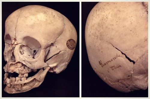 scioddities:  Antique dissected and articulated child skull showing the permanent and temporary teet