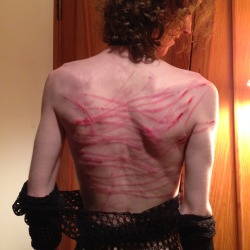 kayden-kox:  Also, for my followers that don’t know I’m something of a masochist. This is my back after a whipping. I don’t if I’m going to be posting more pics like this, and if it isn’t your thing I understand. But here’s this for now. 