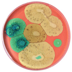 mothermishy:Petri dish art by Klari Reis. 