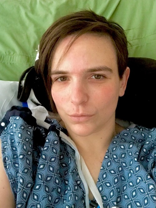 tcfkag: Had surgery two days ago (NG tube is just after waking up) so here are some very rare selfie