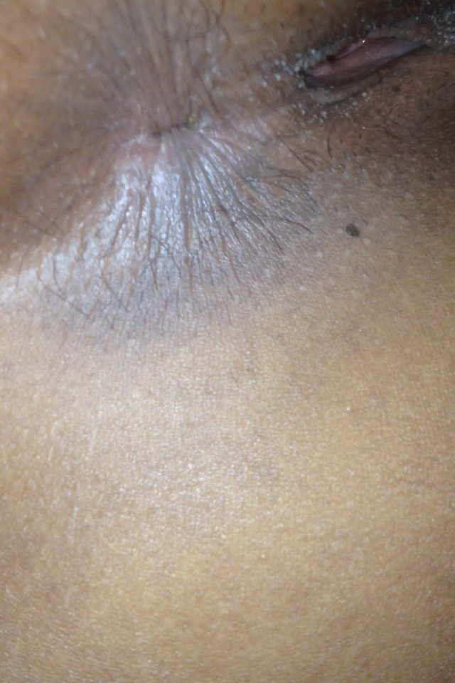 Back Door Black Girls