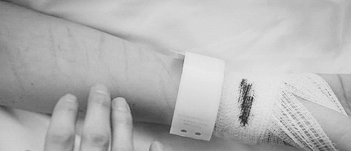 Imperfection Is Beautiful Medical Gif Hunt