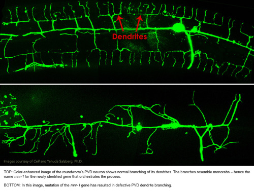 neurosciencestuff:  Previously Unstudied Gene Is Essential for Normal Nerve Development Our ability to detect heat, touch, tickling and other sensations depends on our sensory nerves. Now, for the first time, researchers at Albert Einstein College of