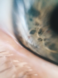 Shoothim:  Today I Made A Macro Lens For My Iphone And These Are Some Of The Photos