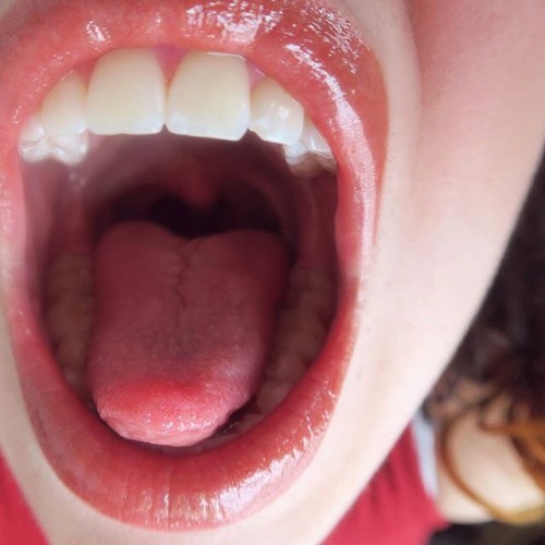 😛😮