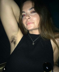 HaiRy ArMpiTs