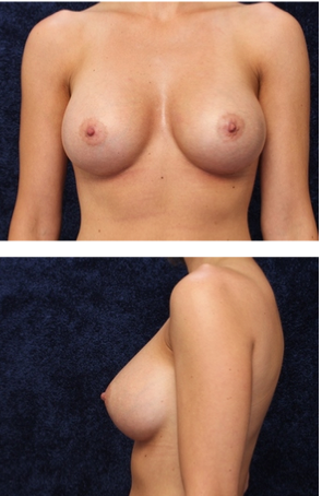 revtilian:  fucktonofanatomyreferencesreborn:  A helpful fuck-ton of boob references.