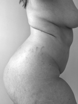 Stretch Mark and Cellulite Appreciation Blog