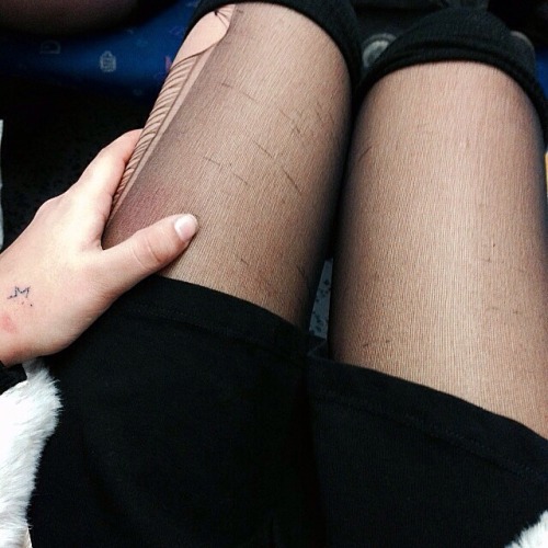 nakedly:half star tattoo, ripped tights, fur coat, bruises on legs and short nailsinstagram @annikab