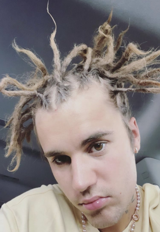 toastpotent:babyfairy:babyfairy:justin bieber having traction alopecia from his disgusting