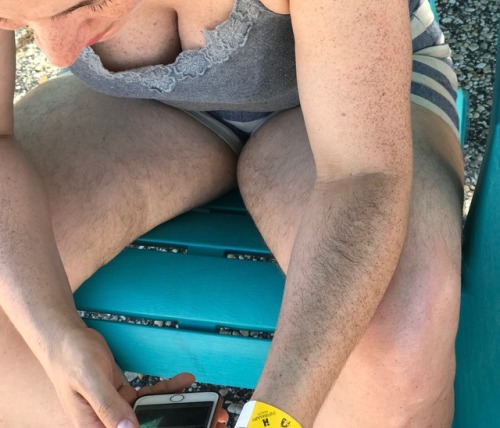 onlyhairywives:Too much sun. Look at my hairy boobs