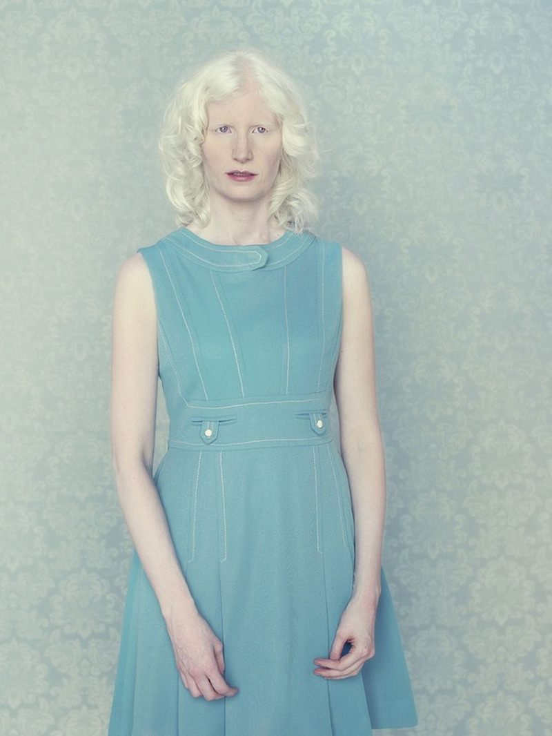 jareth-gates:  likeafieldmouse: Gustavo Lacerda - Albinos (2009-12) 