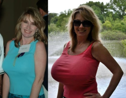 The Gorgeous Nancy Quill, Before And After Her Breast Augmentation.â Nancy Didnâ€™T