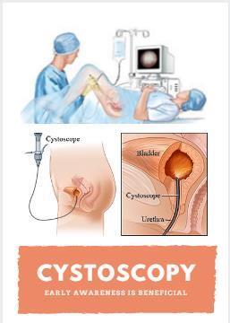 Awareness Of Cystoscopy Is Beneficial By Dr. Kalpesh Kapadia, Urologist In Ahmedabad.