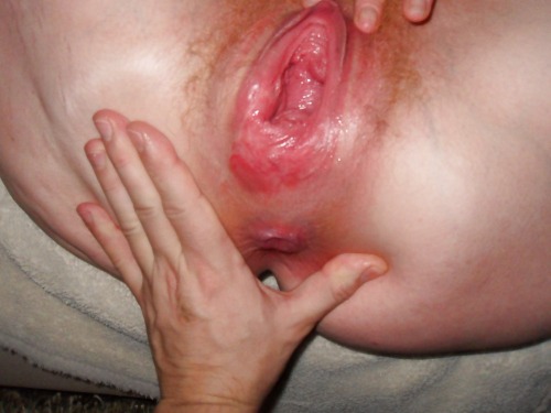 Pussy After Fisting - ditafist: After fist Completely ruined pussy - lovely Tumblr Porn