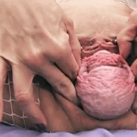 extremeperverseporn:Extreme Prolapsing