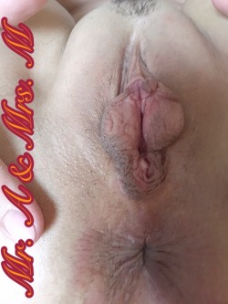 Mraandmrsmcouplesextacy:  Mrs. M Has Such An Inviting Pussy 😍😍And Those Pussy