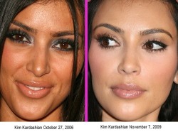 forever90s:  Checkout these Celebs Before &amp; After Cosmetic Surgery! #5 is unbelievable! LOL Kim said she’s had no work done! Check them out: omg kim changed races.  