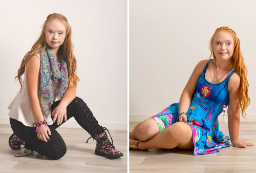 samfangirlism:  toesonlace:  angelclark:    A Teen With Down Syndrome Just Landed A Modelling Contract  Madeline Stuart, the courageous and inspiring teen model with Down syndrome whose story we first told here, has just landed her first major modeling