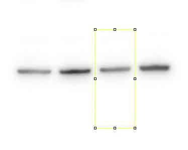 医師のしられざる仕事 Extra Work Of Doctors Image J で Western Blot のデンシトメトリー Densitometry する