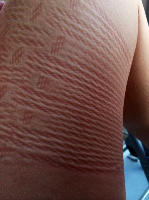 lacy-lane:  little—librarian:  Rope marks   ❣◕ ‿ ◕❣