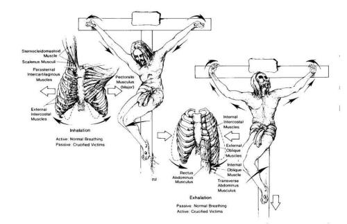 ohifonlyx33: faithful-in-christ: The Anatomical And Physiological Details Of Death By Crucifixion:By