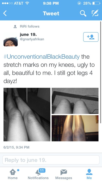 noir-voulex:  nerdrampage:  sharkbaitwhohahaa:  Unconventional Black Beauty is for black girls to embrace their flaws. Often we do not all fit into the standards of black beauty. We are no Beyoncé’s or Rihanna’s but we don’t have to be because