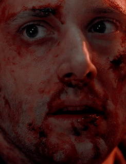 dustydreamsanddirtyscars: #DEAN APPRECIATION WEEKSUNDAY: A Set Dedicated to Dean // Bruised, Bloody and Still Utterly Beautiful
