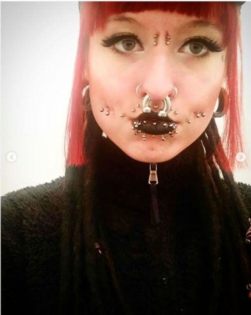 stretched septum