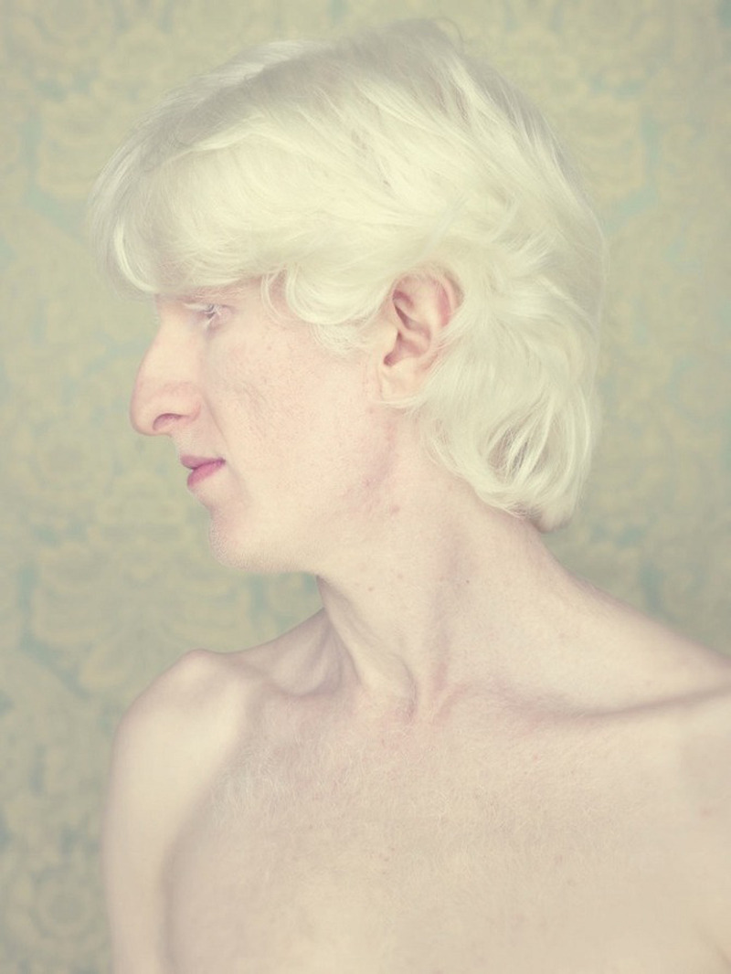 jareth-gates:  likeafieldmouse: Gustavo Lacerda - Albinos (2009-12) 