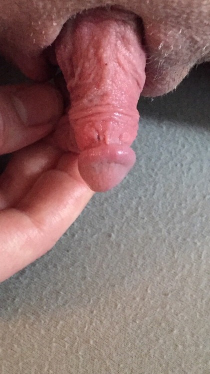 XXX Clitoris photo