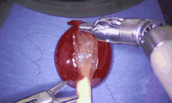 karlmoose:  discoverynews:  Video: Watch a Robot Perform Surgery On a GrapeIf you’ve ever seen stitches, you’re probably aware of just how much focus and precision it takes to get them done well. While our human bodies might not be as genetically