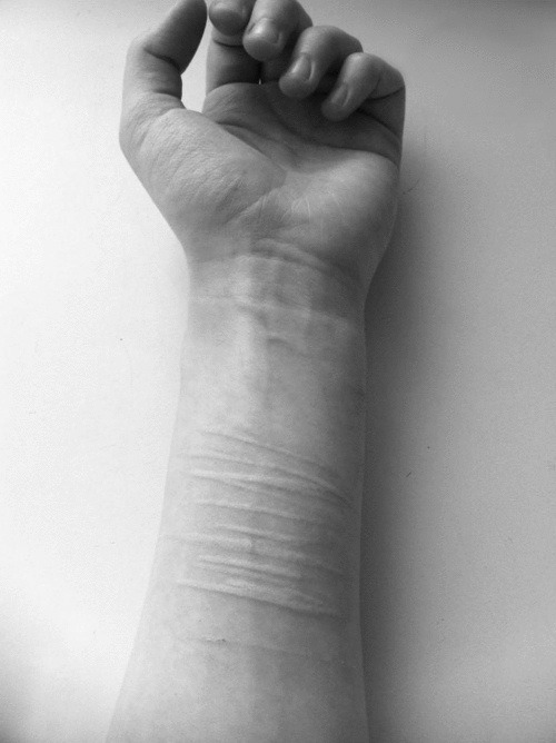 wastedyouth-lostsouls:  ~ 