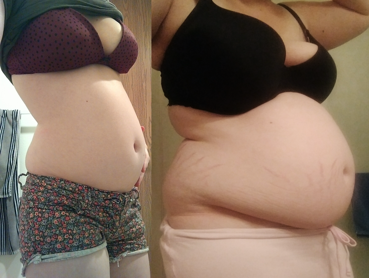 softstretchmark:Another comparison pic, because i love them 135lbs in April 2016 205lbs