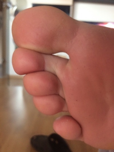 feet-toes-soles-86:  
