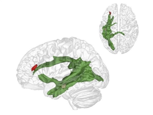 neurosciencestuff:(Image caption: The maturation of fibres of a brain structure called the arcuate f