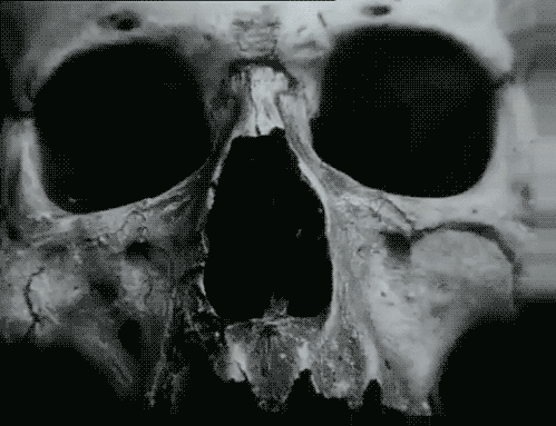 vile-lithium3: