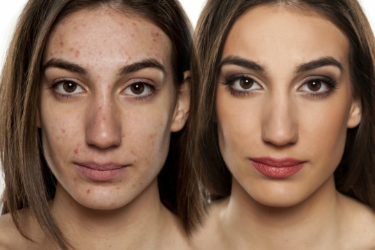 A Comprehensive Guide to Makeup
