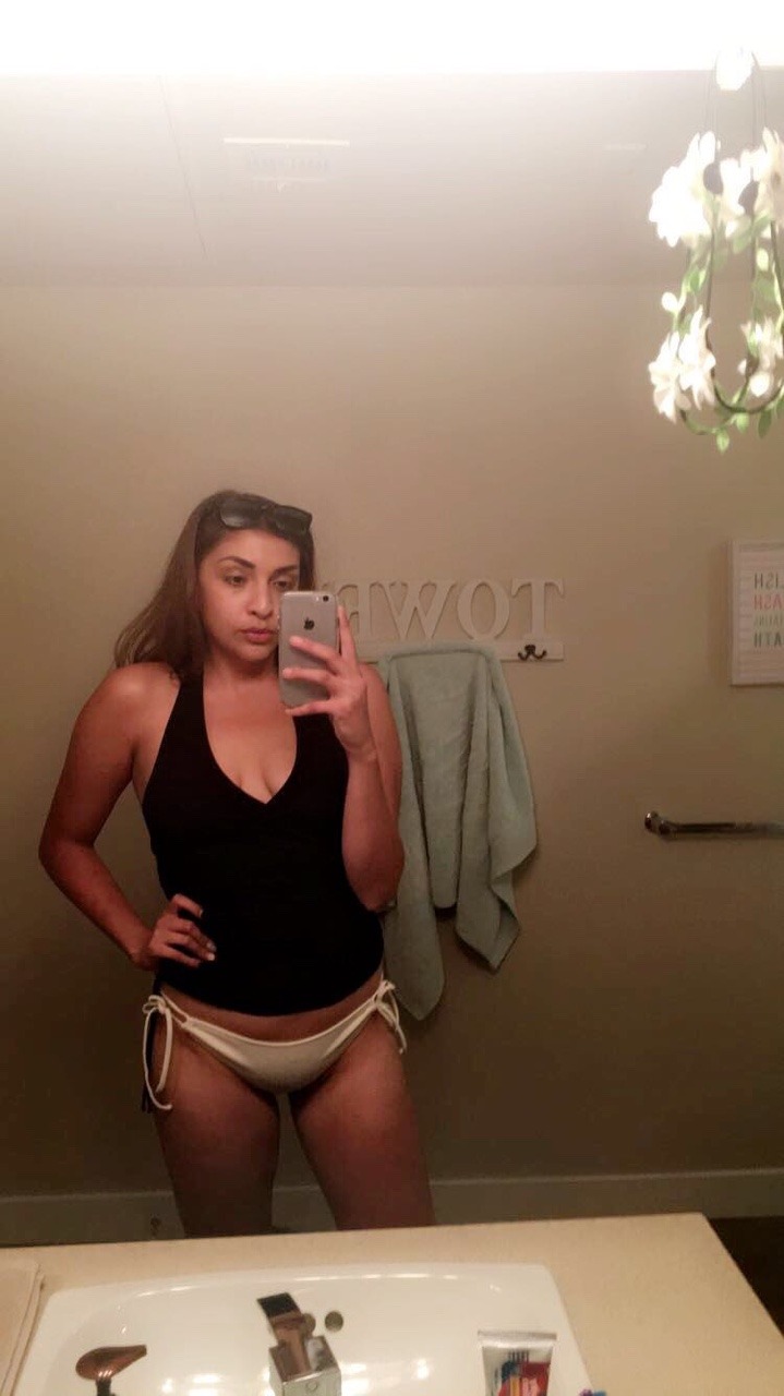 lovelyscars:  Ya girl 🙃😄