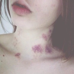 bruises-aand-contusions:  ♞♘♞