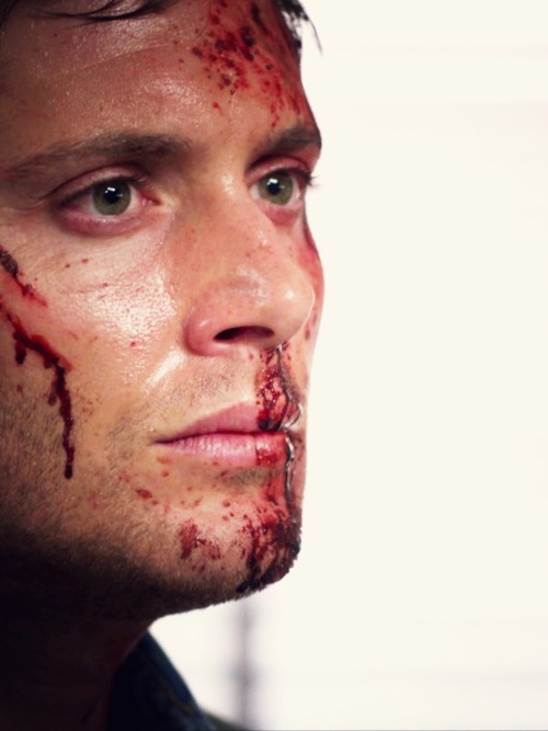 spn-idjits-guide-to-hunting: 9X01 “I Think I’m Gonna Like It Here“  “If I consider this – and I mean