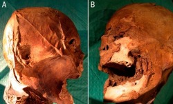 The missing head of French King Henry IV, who died in 1610, was discovered in an attic in 2010. Get the story here: http://www.dailymail.co.uk/news/article-1338777/French-kings-lost-head-Mummified-400-year-old-head-Frances-King-Henri-IV.html