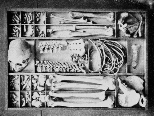 hellothereimhannah:   Entire human skeleton in a box.