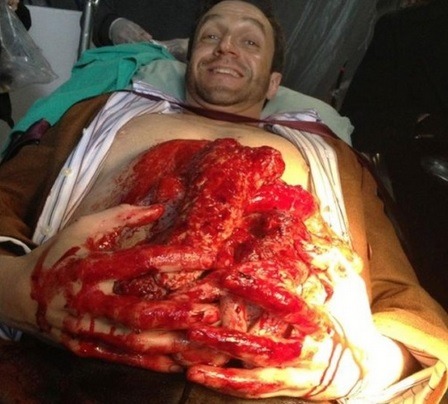 I Love Hannibal Set Pics Because Theyre All So Cheerfully Unmoved By All The Weird Shit