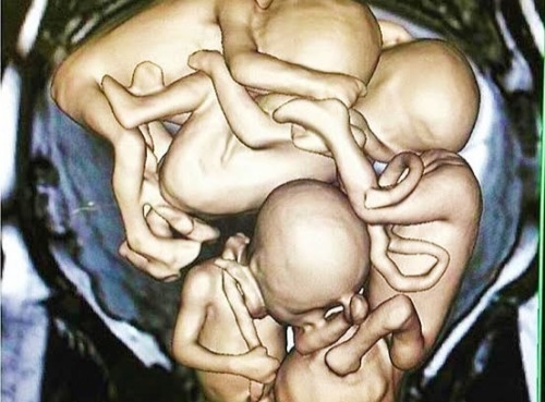 How Many Babies In Mama's Womb? 😳