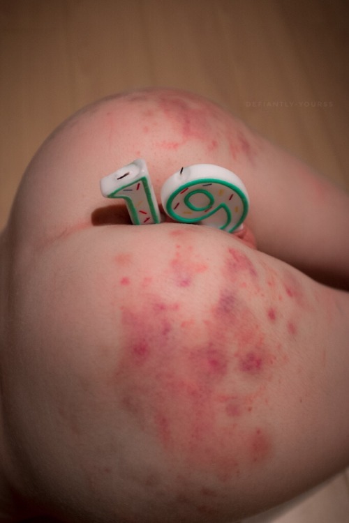 defiantly-yourss:  wtf-mcb-123:  defiantly-yourss:  Birthday cake.  (Thanks @vanerotica for lubing up the candles and not calling me crazy for proposing this idea)  What’s the red irritation on your sexy ass? Candle wax? Allergies?  Bruises from being